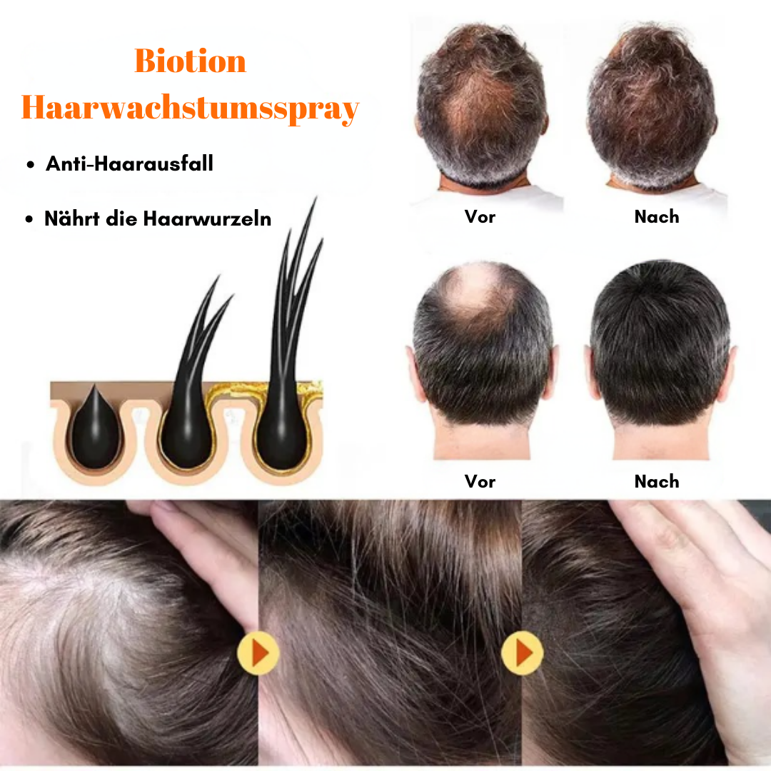 RootRevive™ Biotion Haarwachstumsspray