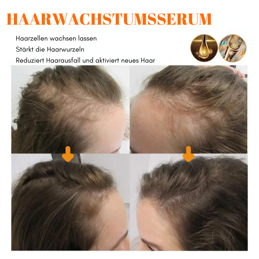 RootRevive™ Biotion Haarwachstumsspray