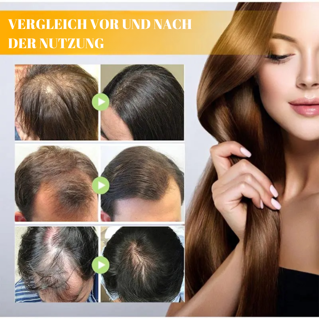 RootRevive™ Biotion Haarwachstumsspray