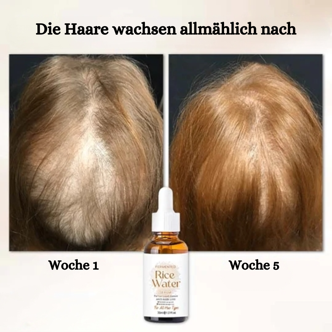 Porevival™ Serum gegen Haarausfall (1+1 GRATIS)