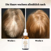 Porevival™ Serum gegen Haarausfall (1+1 GRATIS)
