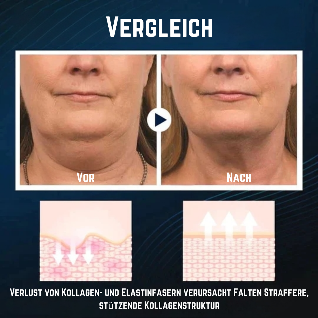 SleepShaper™ Anti-Schnarch V-Face Beauty Device