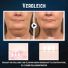 SleepShaper™ Anti-Schnarch V-Face Beauty Device