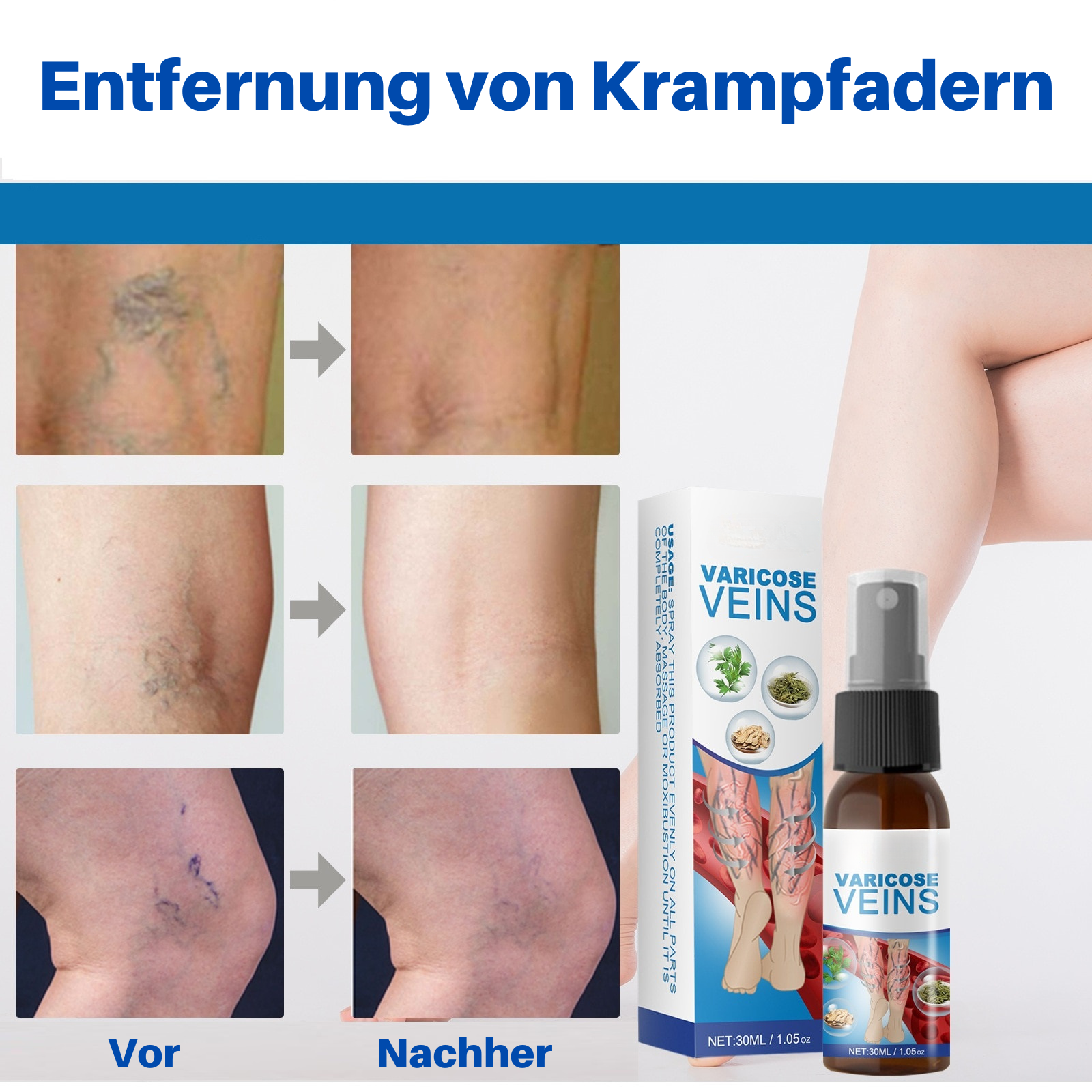 VeinHealer™ - Venenbehandlungsspray (1+1 GRATIS)